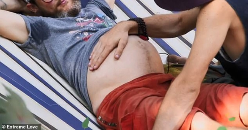 When Dad becomes Mom: A pregnant transgender man and his prenatal depression