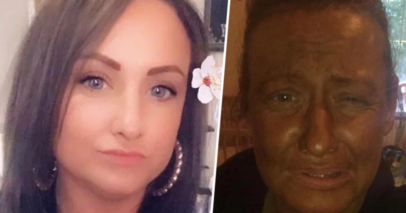 When I decided in the middle of winter to become a super-tanned beauty, and became ... a scarecrow When I decided in the middle of winter to become a super-tanned beauty, and became ... a scarecrow