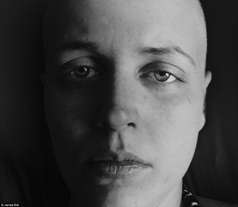 "You'll be fine": photographer captures wife and her battle with cancer