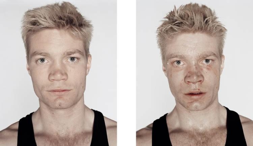 Young boxers: before and after the fight