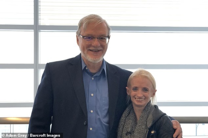 Young "old lady": a woman ages 8 times faster than usual due to "Benjamin Button" syndrome