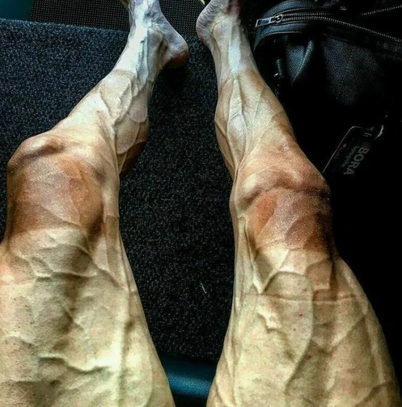 10 Amazing Photos of Athletes Demonstrating the Incredible Powers of the Human Body