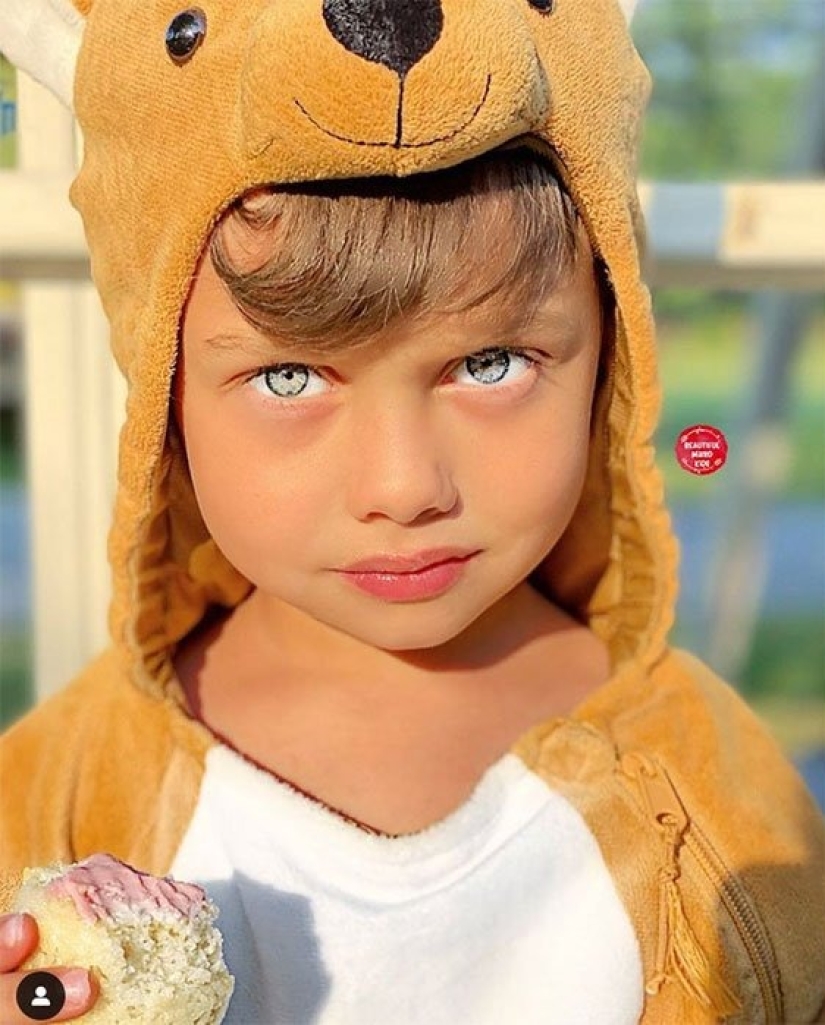 10 children of unique beauty - and all because of an unusual combination of genes 10 children of unique beauty - and all because of an unusual combination of genes