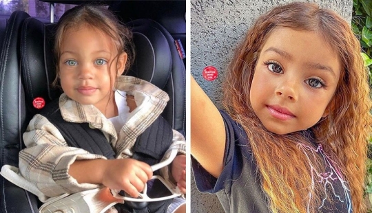 10 children of unique beauty - and all because of an unusual combination of genes 10 children of unique beauty - and all because of an unusual combination of genes