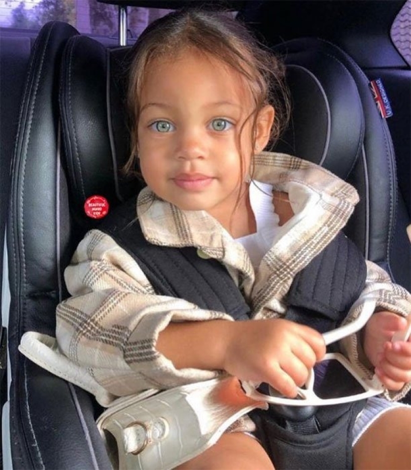10 children of unique beauty - and all because of an unusual combination of genes 10 children of unique beauty - and all because of an unusual combination of genes