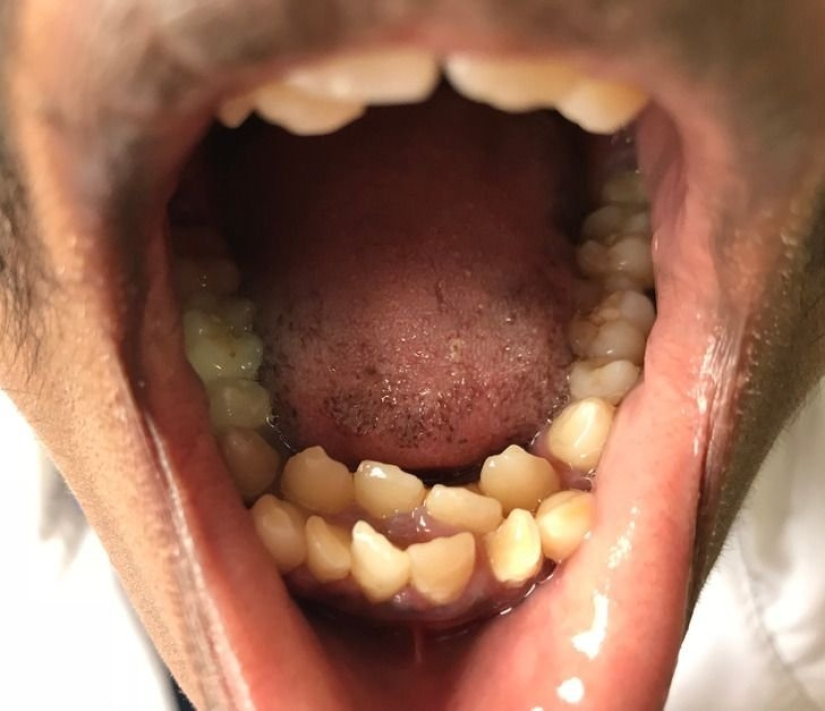 10 features of the human body that are extremely rare