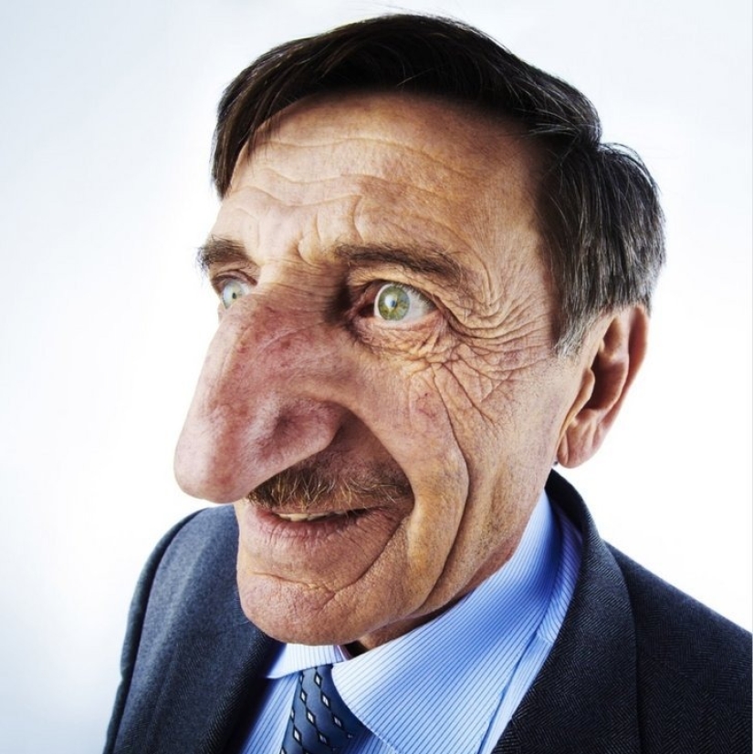 10 features of the human body that are extremely rare