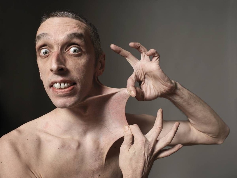 10 features of the human body that are extremely rare