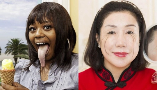 10 features of the human body that are extremely rare 10 features of the human body that are extremely rare