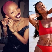 10 models who were considered ugly, but they became mega-popular