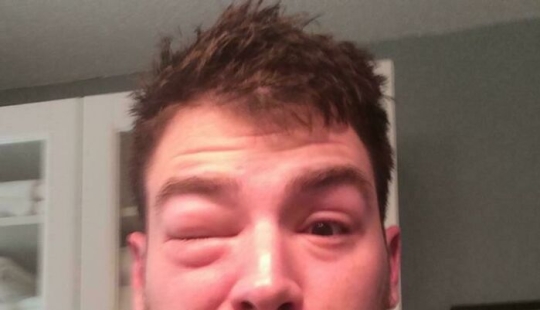 11 de las cosas más desafortunadas con las que la gente se vio obligada a lidiar (Parte 2)