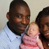 11 years ago, a "white angel" was born to a Nigerian couple. What a beauty the girl has become over the years 11 years ago, a "white angel" was born to a Nigerian couple. What a beauty the girl has become over the years