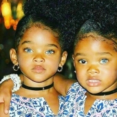 12 years have passed, twin sisters with different eye colors have grown up and become beauties 12 years have passed, twin sisters with different eye colors have grown up and become beauties