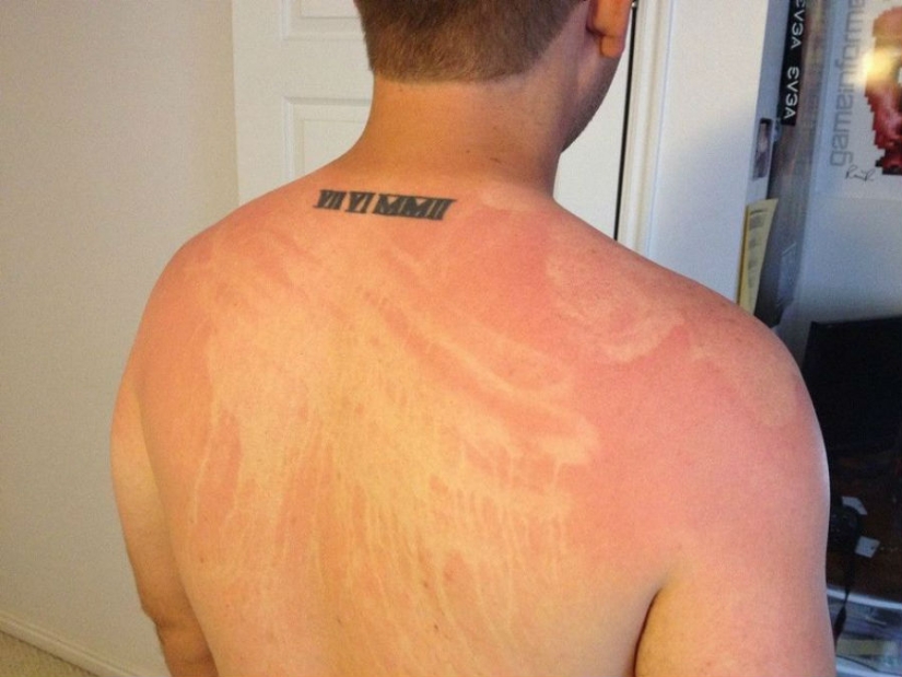 24 people who just don't know how to sunbathe 24 people who just don't know how to sunbathe