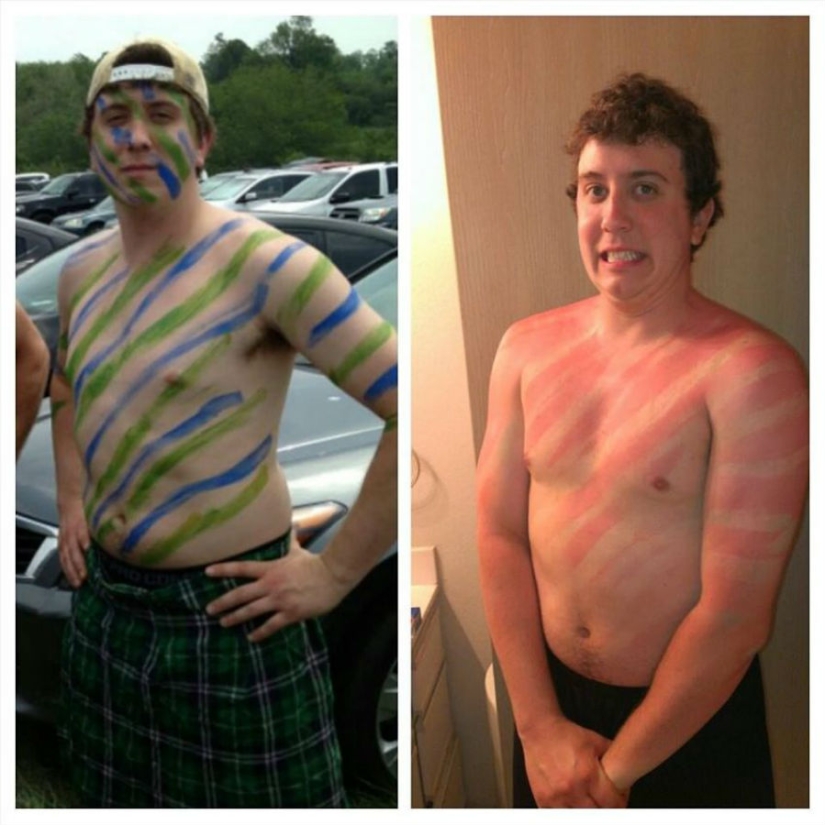 24 people who just don't know how to sunbathe 24 people who just don't know how to sunbathe