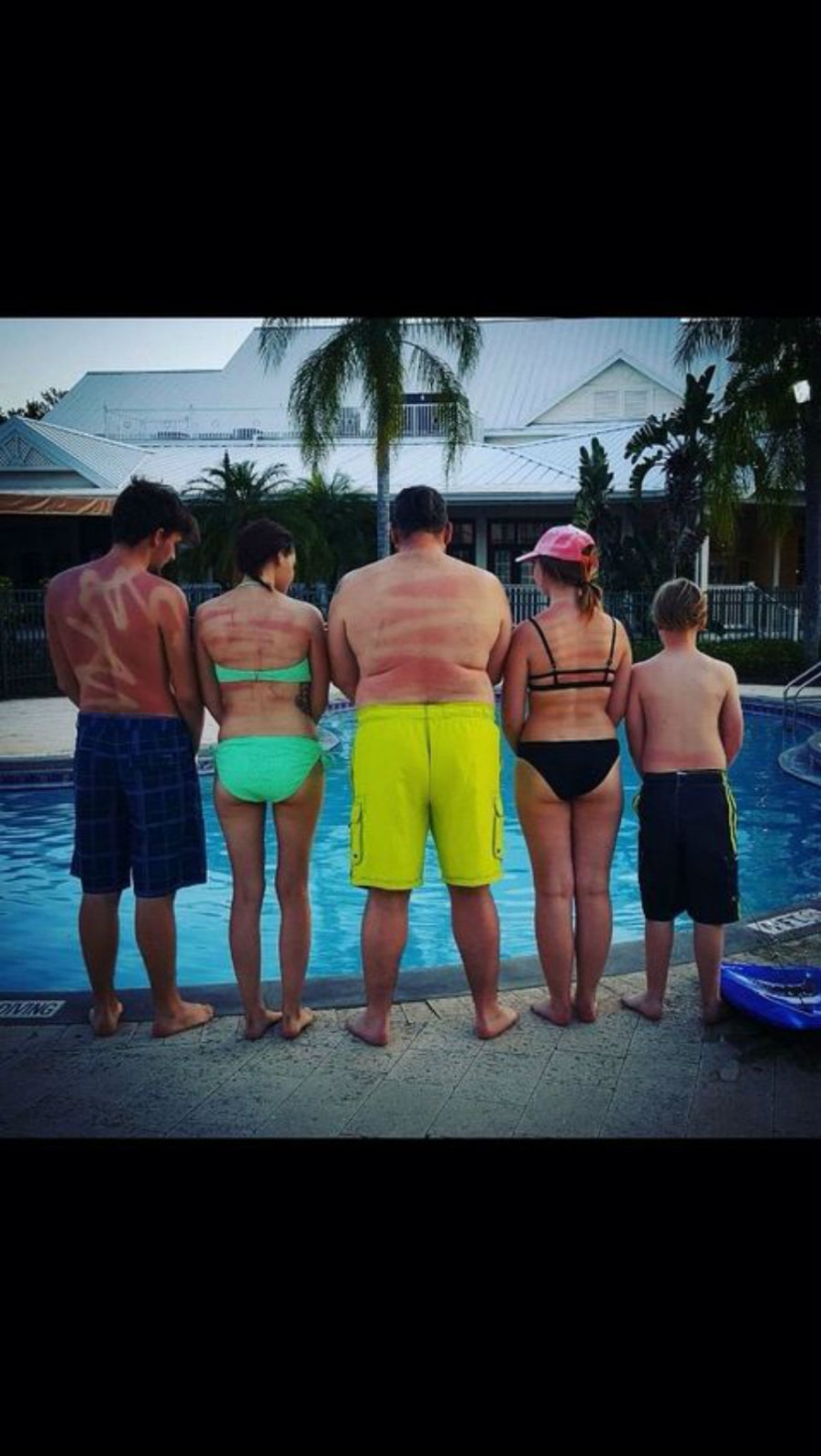 24 people who just don't know how to sunbathe 24 people who just don't know how to sunbathe