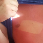 24 people who just don't know how to sunbathe 24 people who just don't know how to sunbathe