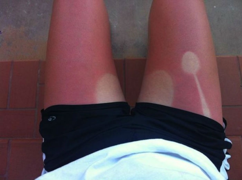 24 people who just don't know how to sunbathe 24 people who just don't know how to sunbathe