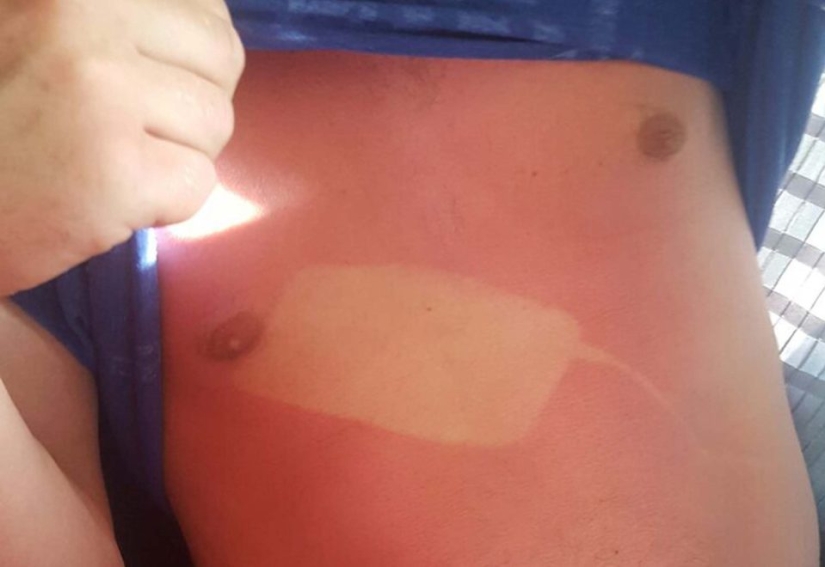 24 personas que simplemente no saben cómo tomar el sol 24 personas que simplemente no saben cómo tomar el sol