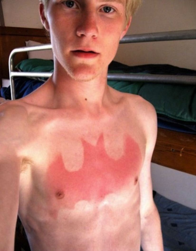 24 personas que simplemente no saben cómo tomar el sol 24 personas que simplemente no saben cómo tomar el sol