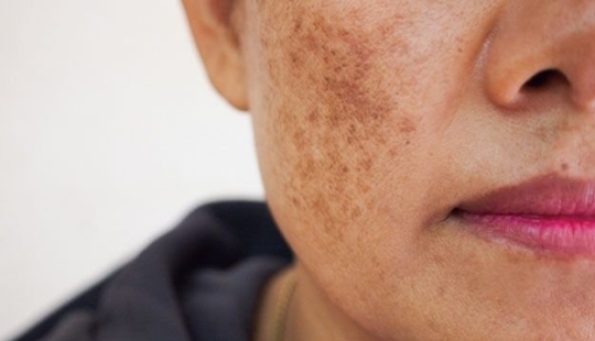 3 puntos que dan la edad de una mujer para los hombres