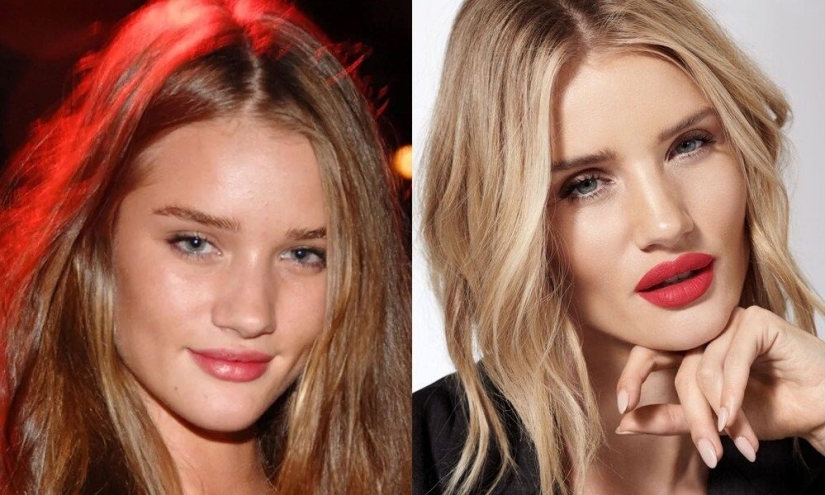 5 examples of successful plastic surgery and 5 more cases of “horror on the wings of the night”
