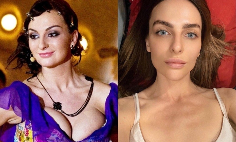5 examples of successful plastic surgery and 5 more cases of “horror on the wings of the night”