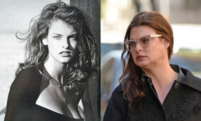 5 examples of successful plastic surgery and 5 more cases of “horror on the wings of the night”