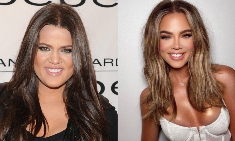 5 examples of successful plastic surgery and 5 more cases of “horror on the wings of the night”