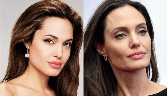 5 examples of successful plastic surgery and 5 more cases of “horror on the wings of the night” 5 examples of successful plastic surgery and 5 more cases of “horror on the wings of the night”