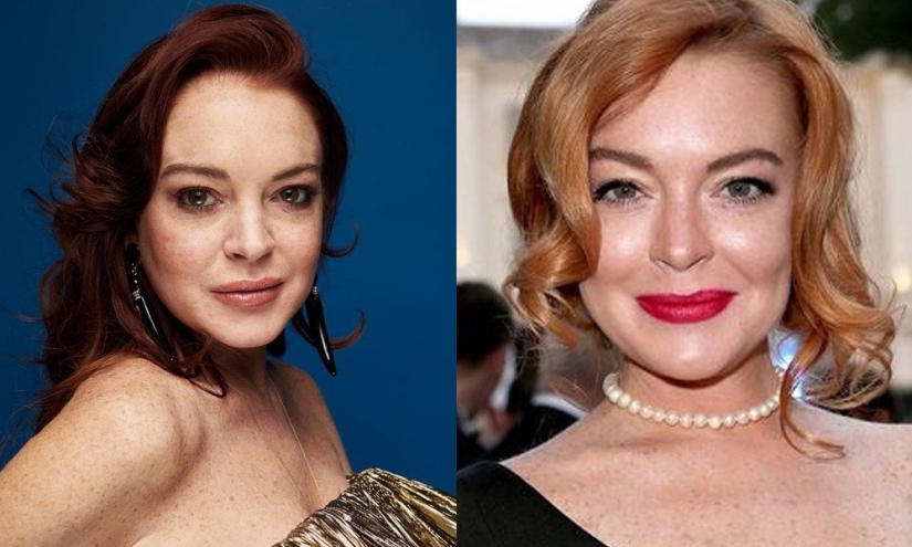 5 examples of successful plastic surgery and 5 more cases of “horror on the wings of the night”