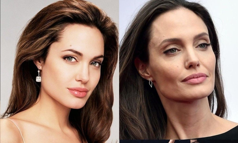 5 examples of successful plastic surgery and 5 more cases of “horror on the wings of the night”
