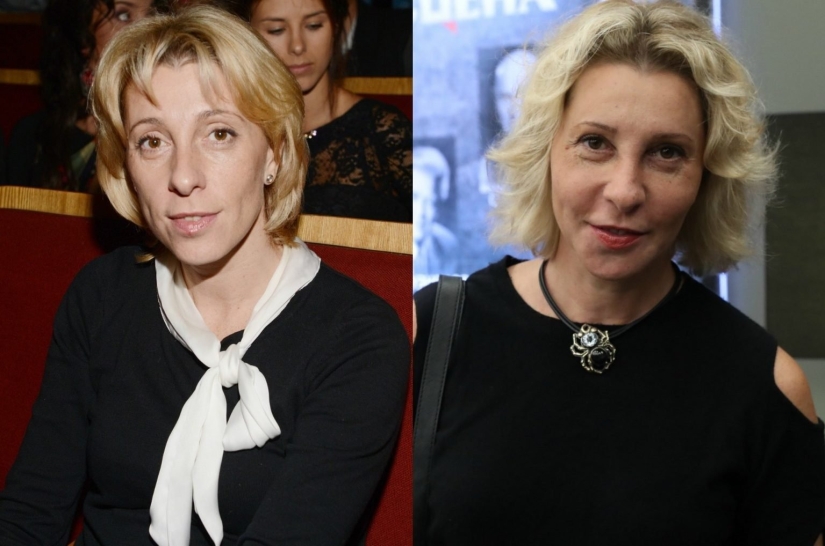 5 examples of successful plastic surgery and 5 more cases of “horror on the wings of the night”