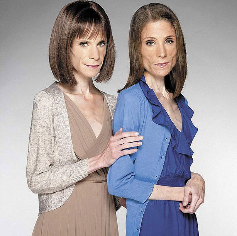 8 celebrities who died of anorexia