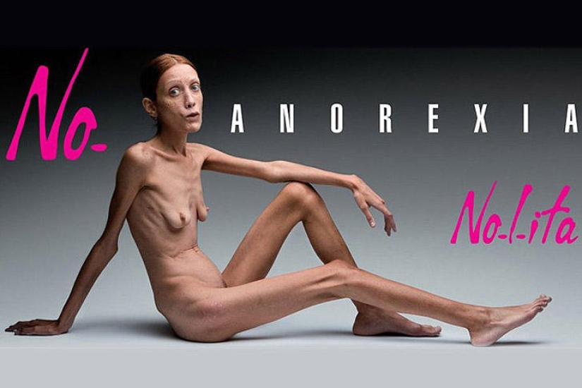 8 celebrities who died of anorexia