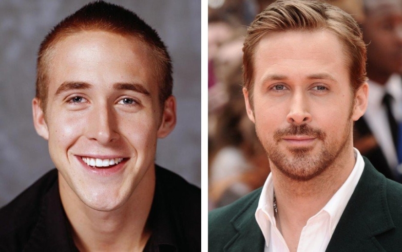 9 star men who have undergone plastic surgery: who got prettier and who regretted it 9 star men who have undergone plastic surgery: who got prettier and who regretted it