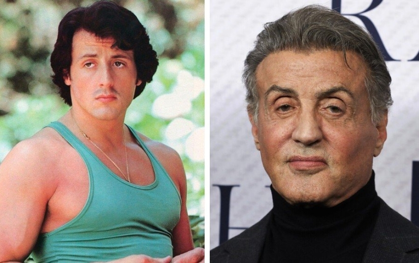 9 star men who have undergone plastic surgery: who got prettier and who regretted it 9 star men who have undergone plastic surgery: who got prettier and who regretted it