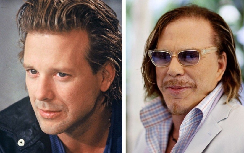 9 star men who have undergone plastic surgery: who got prettier and who regretted it 9 star men who have undergone plastic surgery: who got prettier and who regretted it