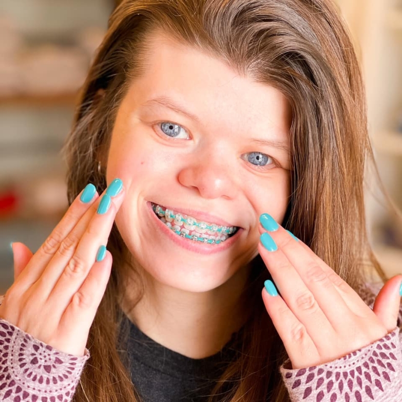 A British woman suffers from a rare disease that makes her fall in love with everyone she meets.