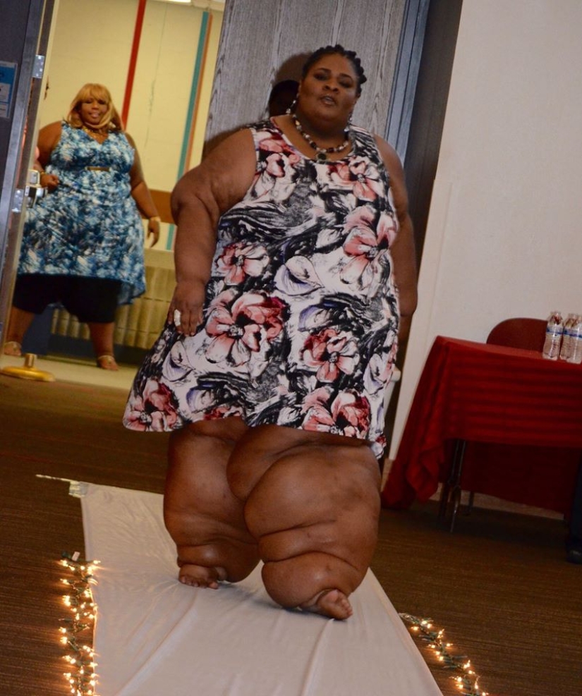 A girl with huge legs also dreams of a beautiful wedding A girl with huge legs also dreams of a beautiful wedding