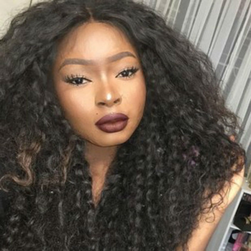 A girl with severe facial burns demonstrates the power of makeup A girl with severe facial burns demonstrates the power of makeup