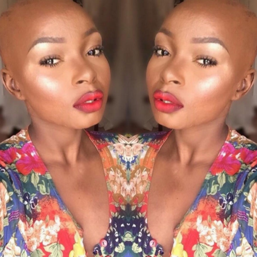 A girl with severe facial burns demonstrates the power of makeup A girl with severe facial burns demonstrates the power of makeup