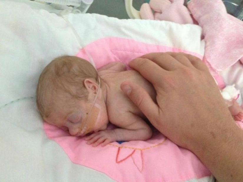 A touching story of a little baby A touching story of a little baby