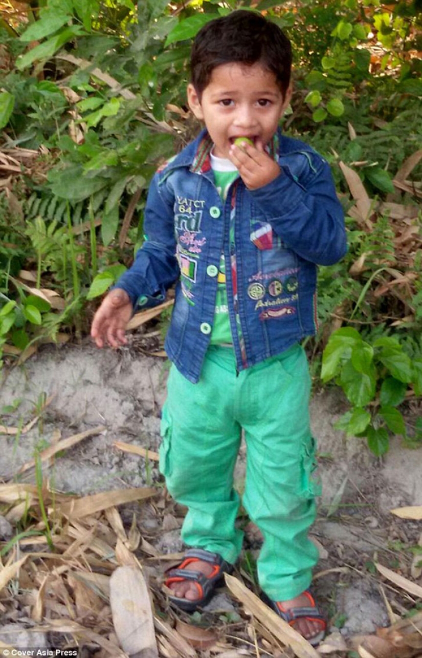 A two-year-old baby from India suffers from premature puberty A two-year-old baby from India suffers from premature puberty