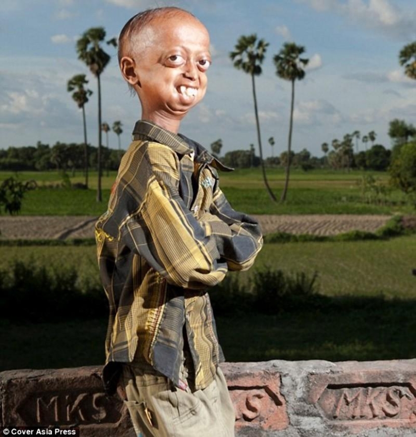 A very rare disease turned the boy into a pensioner A very rare disease turned the boy into a pensioner