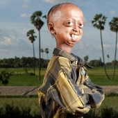 A very rare disease turned the boy into a pensioner