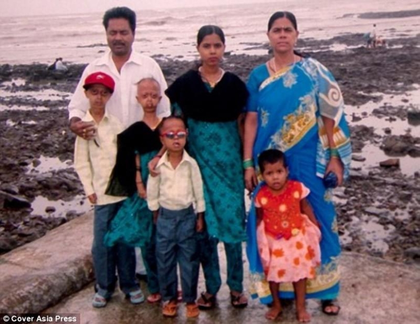 A very rare disease turned the boy into a pensioner A very rare disease turned the boy into a pensioner