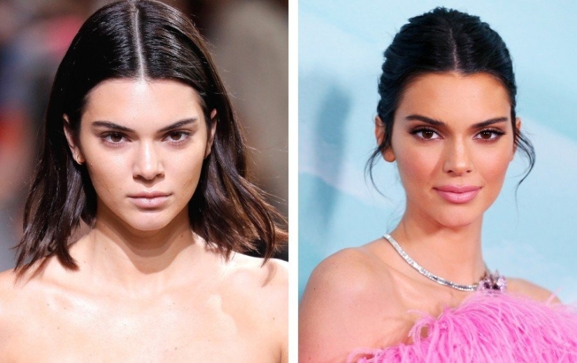 Almost like your own: 9 stars who knowingly made lip plastic surgery