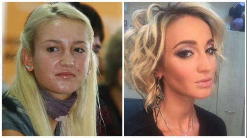 Antes de la fama y la cirugía plástica: 15 fotos de cómo eran las estrellas rusas en su juventud