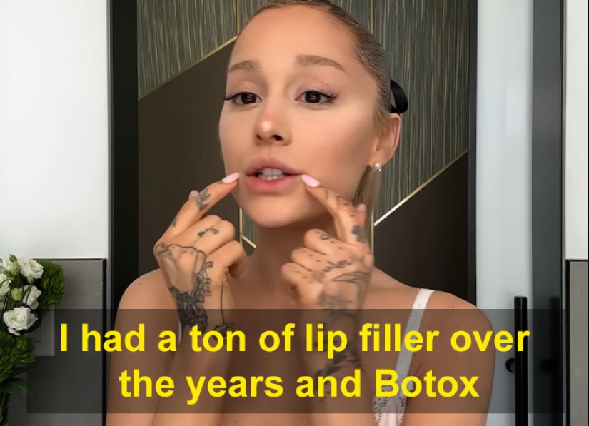 Ariana Grande admite haber usado Botox y rellenos de labios para cambiar su apariencia en el pasado
